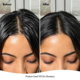 Bondi Boost Hair Growth Dry Shampoo