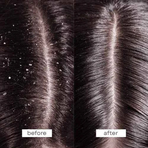 Pump Scalp Therapy Shampoo