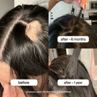 Bondi Boost Hair Growth Boost Trio