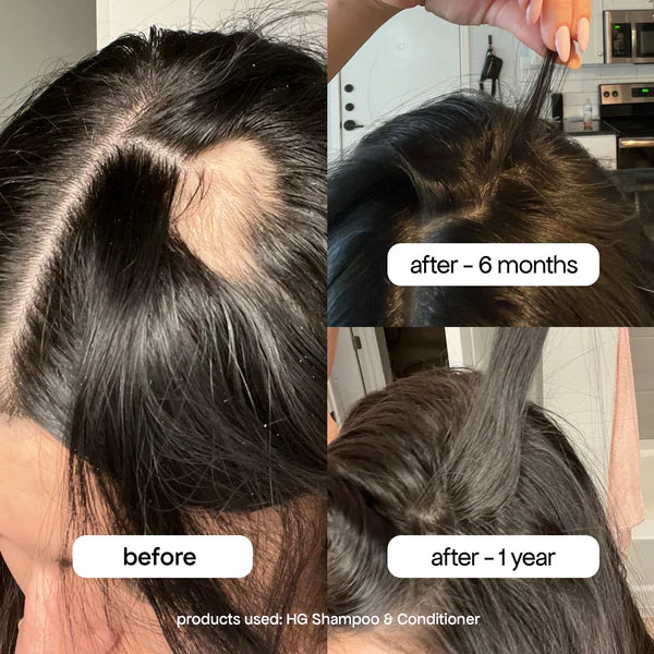 Bondi Boost Hair Growth Boost Trio