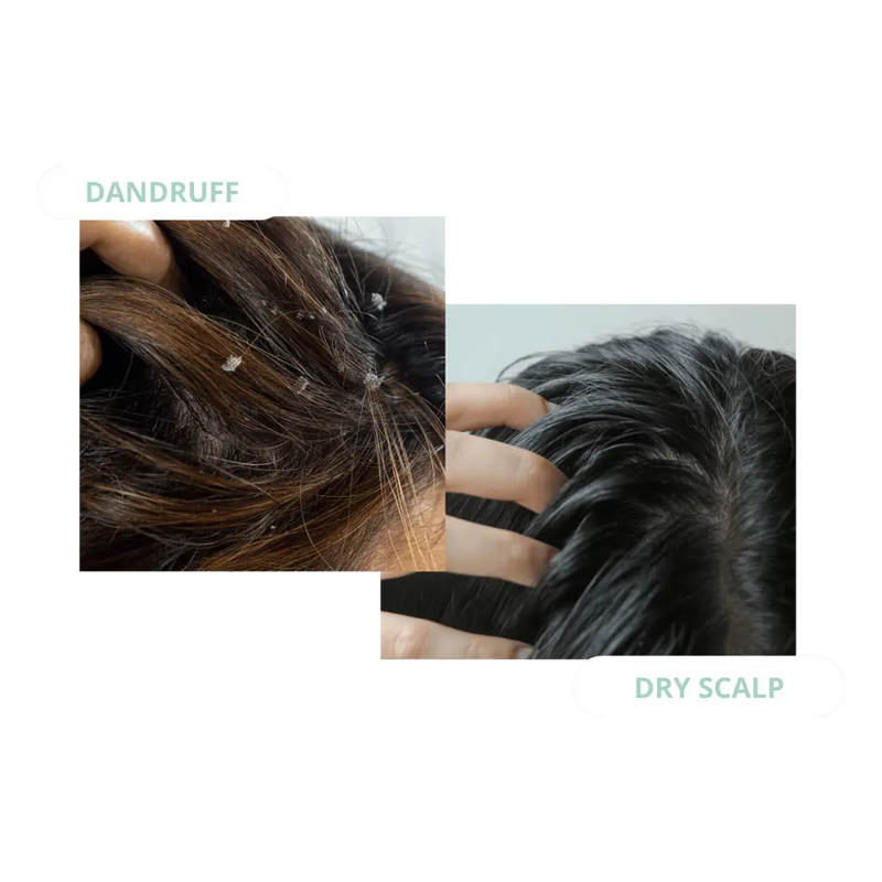 Pump Scalp Tonic Trio